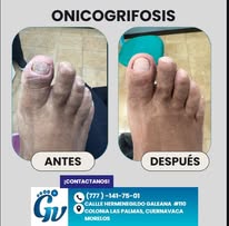 Tratamientos podológicos